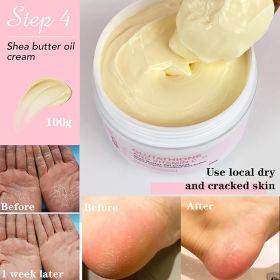 AILKE Vitamin C Lotion. Advanced Brightening Cream. Whiten Serum Remove Melanin, Age Spots, Dark Spots On Face, Hands, Body. (Color: Shea Butter Cream)